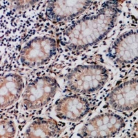 Collagen 17 alpha 1 Rabbit Polyclonal Antibody