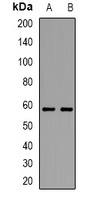 TRP2 Rabbit Polyclonal Antibody