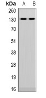 NFAT5 Rabbit Polyclonal Antibody