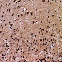 NFAT5 Rabbit Polyclonal Antibody