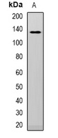 Telomerase Rabbit Polyclonal Antibody