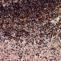 Telomerase Rabbit Polyclonal Antibody
