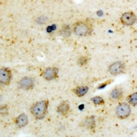 BID (Phospho-S78) Rabbit Polyclonal Antibody