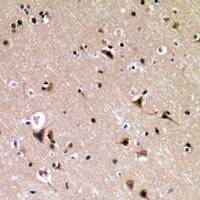 p53 (Phospho-S376) Rabbit Polyclonal Antibody