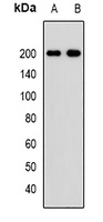 PDGFR beta Rabbit Polyclonal Antibody