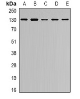Collagen 4 alpha 1 Rabbit Polyclonal Antibody