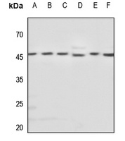 Beta-tubulin Antibody