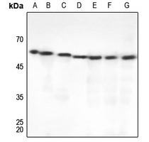 Beta-tubulin Antibody
