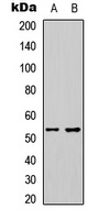 ETS1 Rabbit Polyclonal Antibody