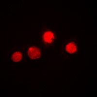 ETS1 Rabbit Polyclonal Antibody