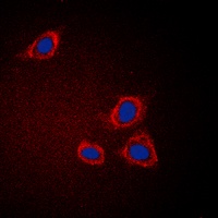 GAB1 Rabbit Polyclonal Antibody