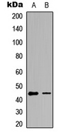 GATA1 (Phospho-S142) Rabbit Polyclonal Antibody