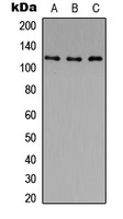 Histone Deacetylase 5/9 (Phospho-S259/220) Rabbit Polyclonal Antibody