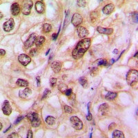 Histone Deacetylase 5/9 (Phospho-S259/220) Rabbit Polyclonal Antibody