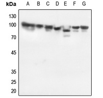 HSP90 beta Antibody [KO/KD Validated]