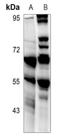 CD213a2 Rabbit Polyclonal Antibody