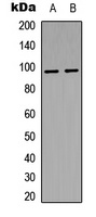 Insulin Receptor (Phospho-Y1361) Antibody