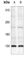 IRS1 (Phospho-S307) Rabbit Polyclonal Antibody