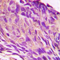 IRS1 (Phospho-S307) Rabbit Polyclonal Antibody