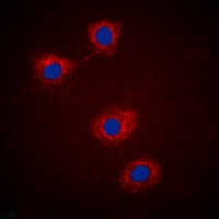 IRS1 (Phospho-S307) Rabbit Polyclonal Antibody