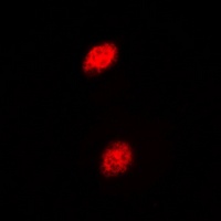 Islet-2 Rabbit Polyclonal Antibody