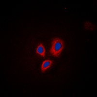 CD29 (Phospho-T789) Rabbit Polyclonal Antibody