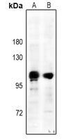CD61 (Phospho-Y785) Rabbit Polyclonal Antibody