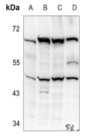 Kir2.1 Rabbit Polyclonal Antibody