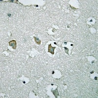 Kir2.1 Rabbit Polyclonal Antibody