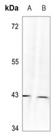 p38 (Phospho-Y323) Antibody