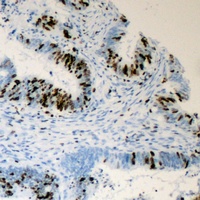 TRAP220 (Phospho-T1457) Antibody