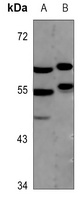 MEF2A Rabbit Polyclonal Antibody