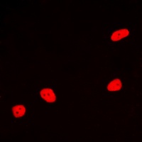 MEF2A Rabbit Polyclonal Antibody