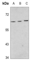 MEF2D (Phospho-S444) Rabbit Polyclonal Antibody