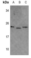 MRPL40 Rabbit Polyclonal Antibody