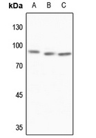 MTA1 Rabbit Polyclonal Antibody