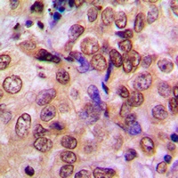MTA1 Rabbit Polyclonal Antibody
