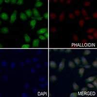 MTA1 Rabbit Polyclonal Antibody