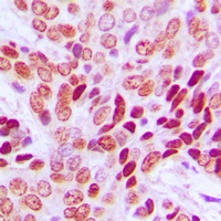 c-Myc Rabbit Polyclonal Antibody