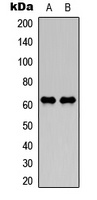 NEFL Rabbit Polyclonal Antibody