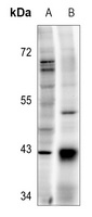 TOPK (Phospho-T9) Rabbit Polyclonal Antibody