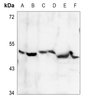PDK2 Rabbit Polyclonal Antibody