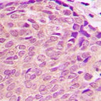 PDK2 Rabbit Polyclonal Antibody