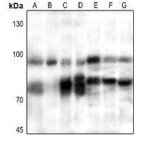 PFKM Rabbit Polyclonal Antibody