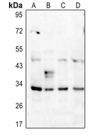 DARPP32 (Phospho-T34) Antibody