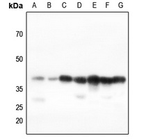 AMPK beta 1 Rabbit Polyclonal Antibody
