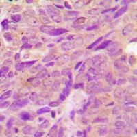 AMPK beta 1 Rabbit Polyclonal Antibody