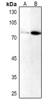 PKC iota/zeta (Phospho-T412/410) Rabbit Polyclonal Antibody