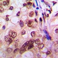 PKC iota/zeta (Phospho-T412/410) Rabbit Polyclonal Antibody