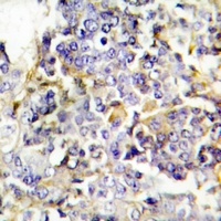 PTX3 Rabbit Polyclonal Antibody